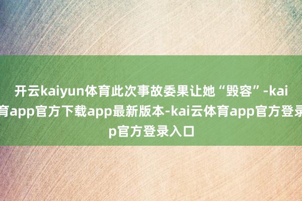 开云kaiyun体育此次事故委果让她“毁容”-kai云体育app官方下载app最新版本-kai云体育app官方登录入口